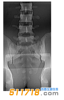 1535016002176928.png 美國CIRS 034腰椎穿刺訓練模體1.png