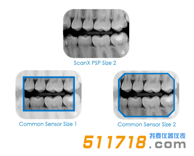 1557221931523171.png 美國AIR TECHNIQUES ScanX Duo數(shù)字X射線系統(tǒng) 口腔掃描儀2.png