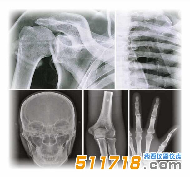 德國QUART全身X射線模體.jpg 德國QUART全身X射線模體.jpg