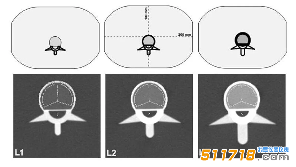 1768967743112363.png QRM-ESP 的 CT 圖像。椎體中段掃描圖像,并疊加了自動確定的松質骨和皮質骨 ROI。.png